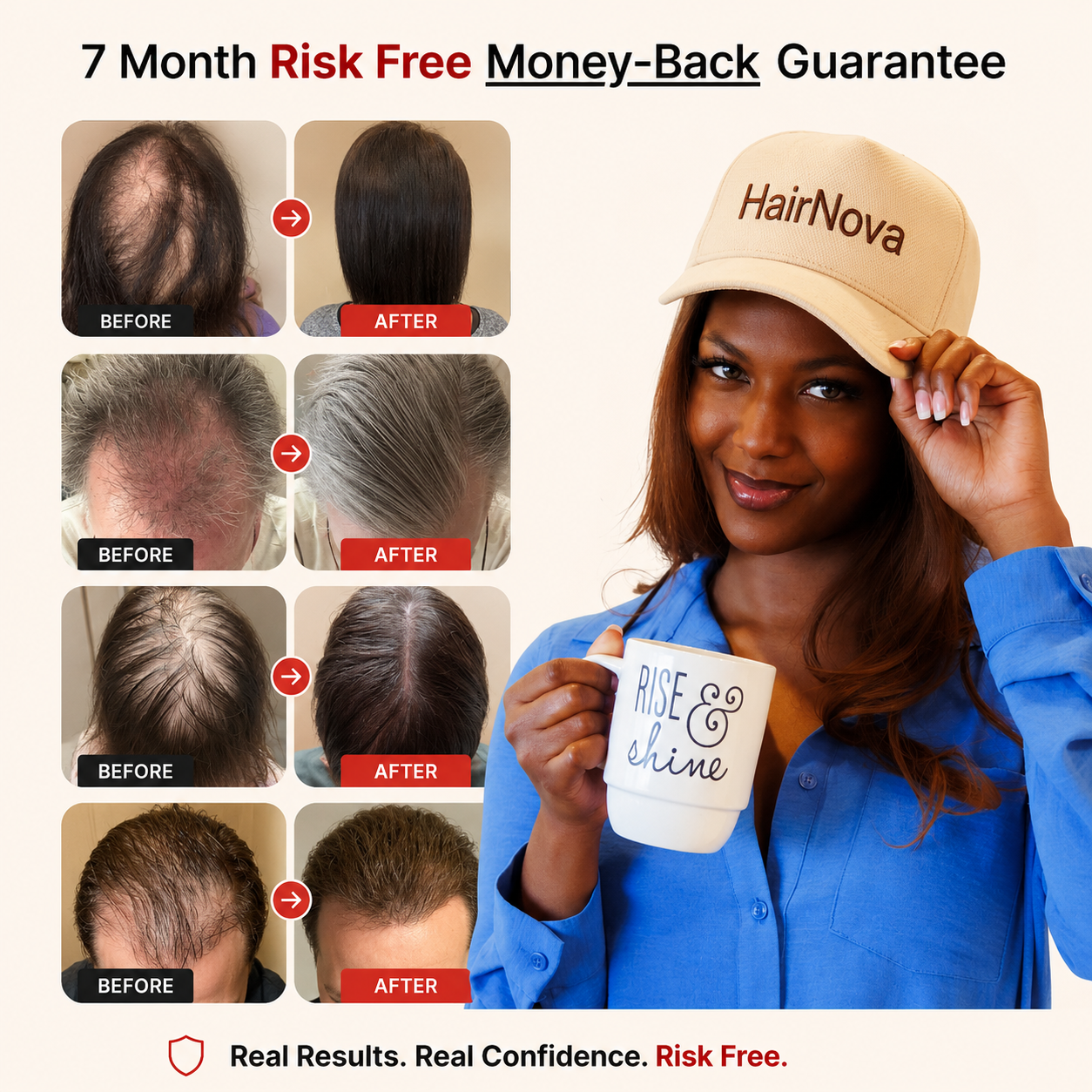HairNova™ Pro Laser Cap